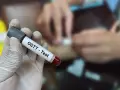 Ręka w rękawiczce trzyma probówkę z krwią z oznaczeniem "OGTT - Test". W tle widać proces pobierania krwi, kluczowy dla test obciążenia glukozą 75g interpretacja wyników.