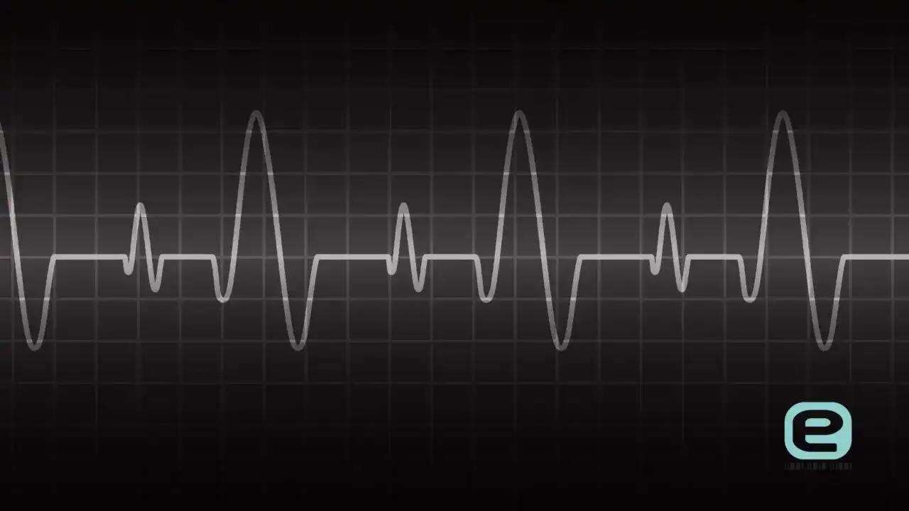 Linia EKG na czarnym tle. Czy nerwica serca wyjdzie na EKG? Wykres pokazuje nieregularne tętno.
