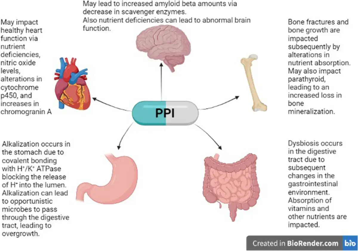 Inhibitory pompy protonowej (PPI) wpływają na serce, mózg, kości i jelita, powodując niedobory, dysbiozę i problemy z wchłanianiem.