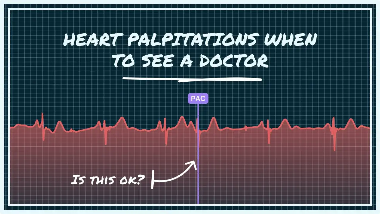 EKG z zaznaczonym pojedynczym skurczem dodatkowym (PAC). Czy kołatanie serca przyczyny są groźne?